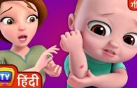 बेबी को लगी चोट (The Boo Boo Song) – Hindi Rhymes For Children – ChuChu TV