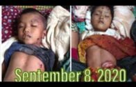 Stop the bloody killing in Arakan